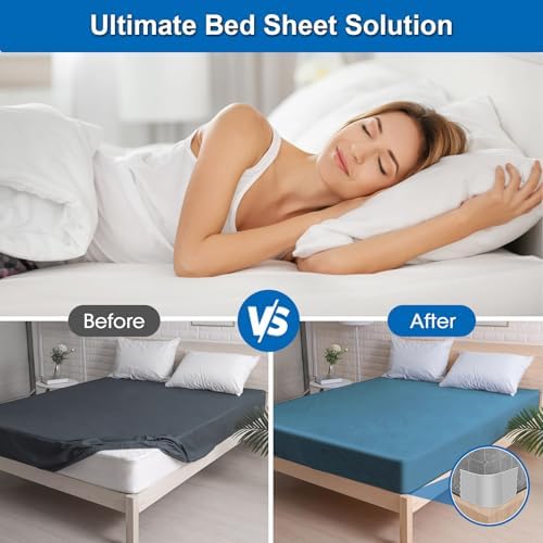 Lizemqqi Sheet Fasteners 2 Set Non-Slip Light Grey